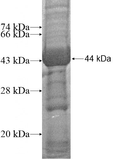 Recombinant Human GTPBP5 SDS-PAGE