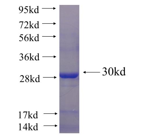 Recombinant human YRDC SDS-PAGE