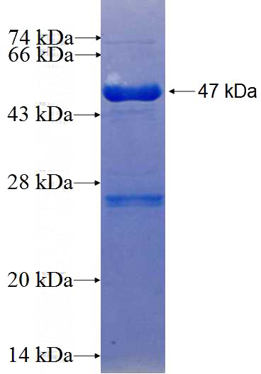 Recombinant Human DMXL2 SDS-PAGE