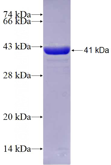 Recombinant Human KLHL32 SDS-PAGE