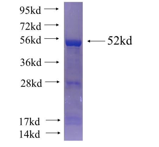 Recombinant human EFCAB4B SDS-PAGE