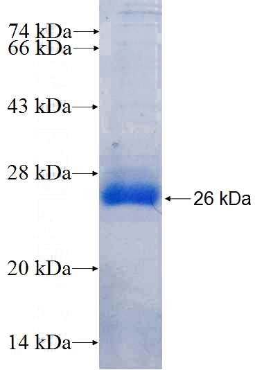 Recombinant Human 3BP2 SDS-PAGE