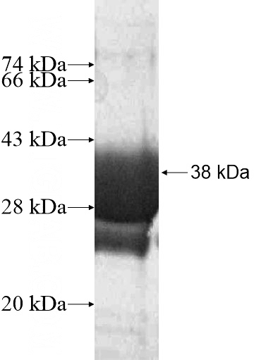Recombinant Human RBM33 SDS-PAGE