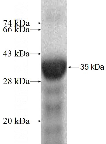 Recombinant Human USP45 SDS-PAGE