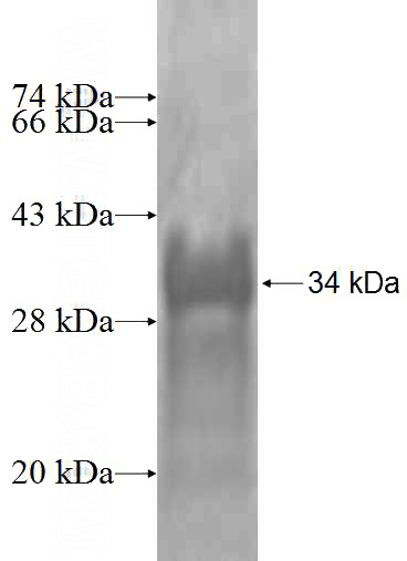 Recombinant Human ANXA8 SDS-PAGE