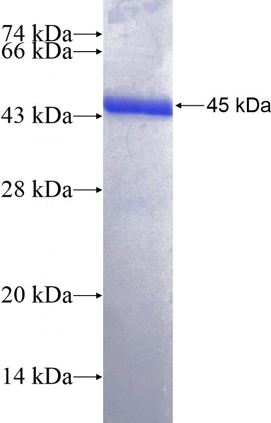 Recombinant Human BTG4 SDS-PAGE