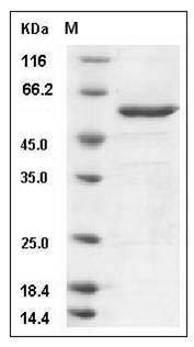 Mouse ITK Kinase Protein (aa 351-619, His & GST Tag) SDS-PAGE