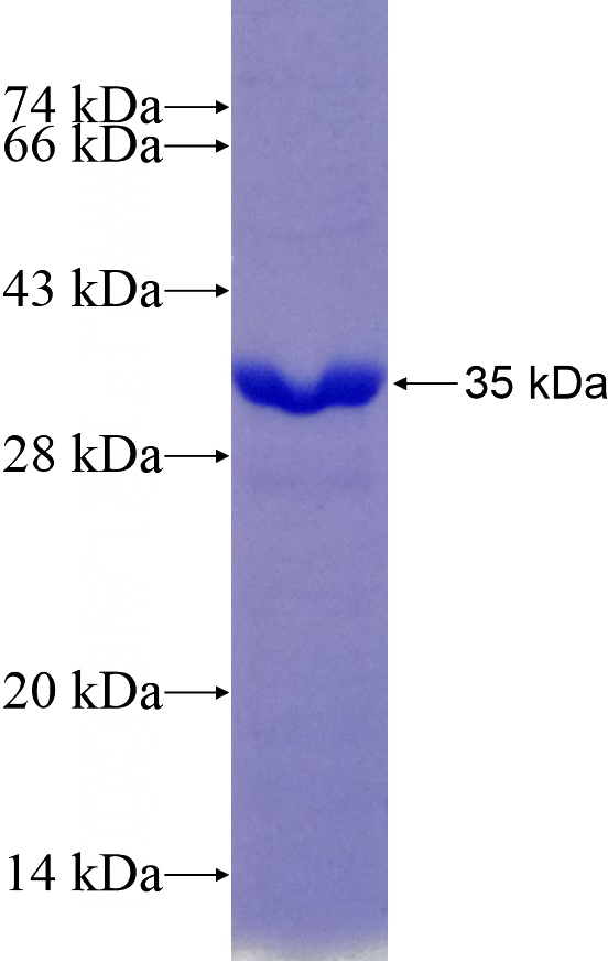 Recombinant Human PDGFD SDS-PAGE