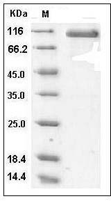 Human DLL4 Protein (Fc Tag) SDS-PAGE