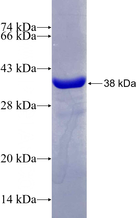 Recombinant Human HNRNPA2B1 SDS-PAGE
