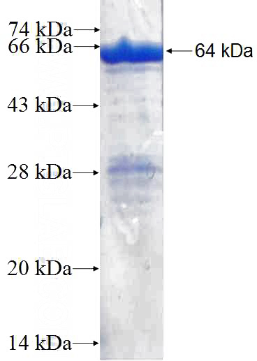 Recombinant Human TLN1 SDS-PAGE