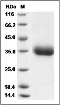 Rat Layilin / LAYN Protein (His Tag) SDS-PAGE