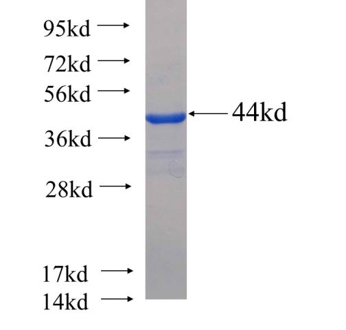 Recombinant human APTX SDS-PAGE