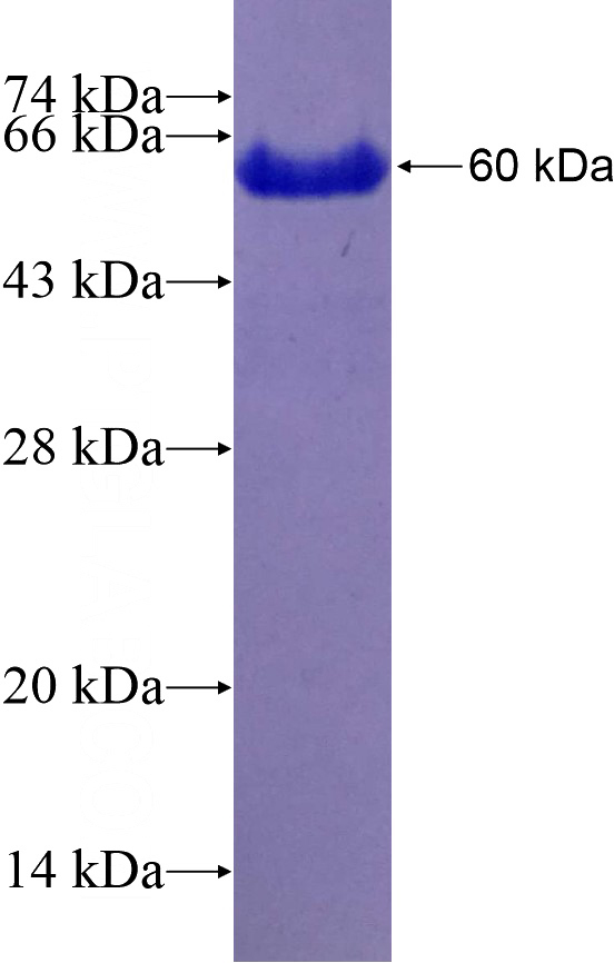 Recombinant Human USP33 SDS-PAGE