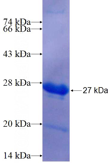 Recombinant Human CITED1 SDS-PAGE