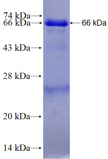 Recombinant Human FBXO30 SDS-PAGE