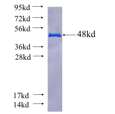 Recombinant human STX10(Full length) SDS-PAGE