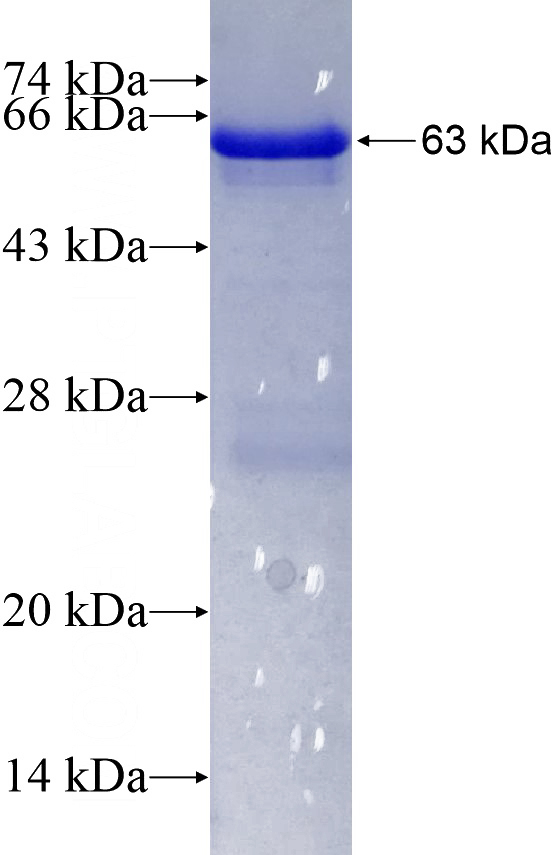 Recombinant Human AK5 SDS-PAGE