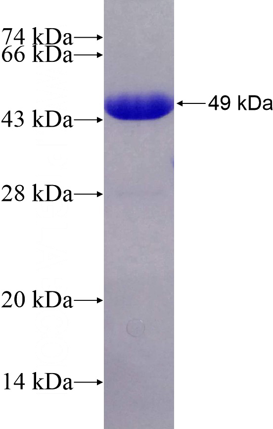 Recombinant Human USP37 SDS-PAGE