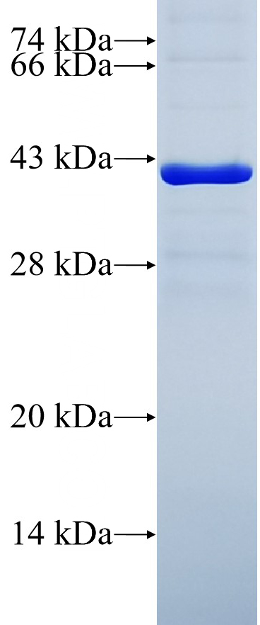 Recombinant human KIAA0776 SDS-PAGE