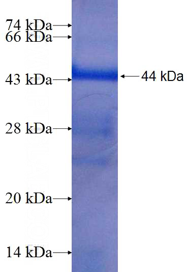 Recombinant Human SHOX2 SDS-PAGE