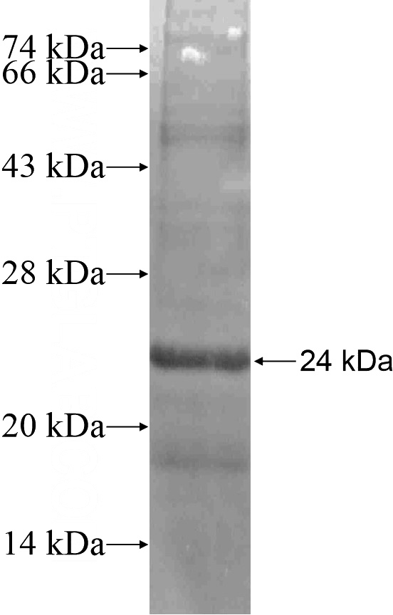 Recombinant Human JUP SDS-PAGE