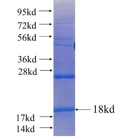 Recombinant human NDUFV3(Full length) SDS-PAGE