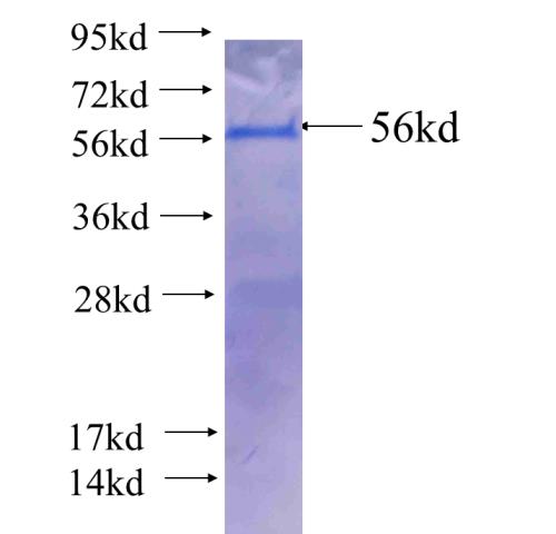 Recombinant human MLN64,STARD3 SDS-PAGE