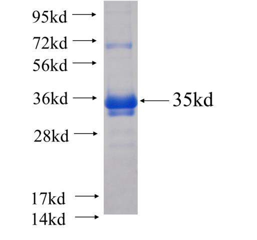 Recombinant human STX6(Full length) SDS-PAGE