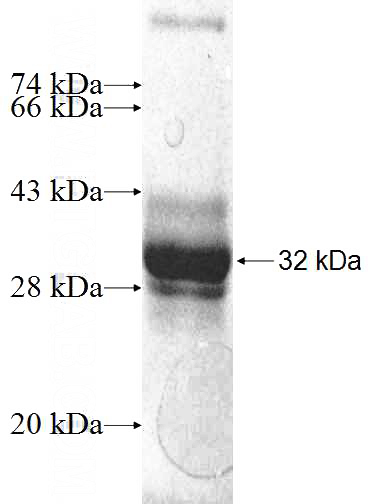 Recombinant Human LDHAL6A SDS-PAGE
