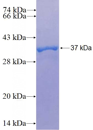 Recombinant Human HIF1AN SDS-PAGE