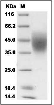 Human LFA-3 / CD58 Protein (His Tag) SDS-PAGE