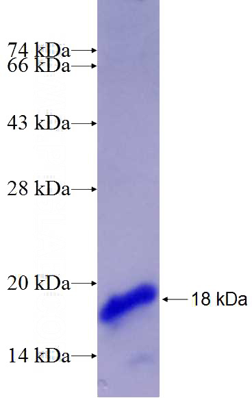 Recombinant Human SLC22A16 SDS-PAGE