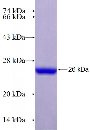 Recombinant Human CTSW SDS-PAGE