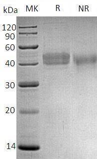 Human DKK1/UNQ492/PRO1008 (His tag) recombinant protein