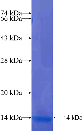 Recombinant Human ASPHD1 SDS-PAGE