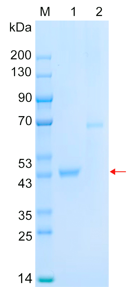 Recombinant FCRL4 protein (His tag) SDS-PAGE
