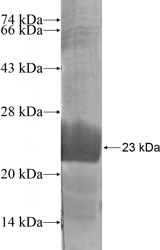 Recombinant Human ADAM21 SDS-PAGE