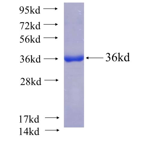 Recombinant human EXOSC8(Full length) SDS-PAGE