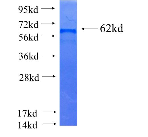 Recombinant human XAB2 SDS-PAGE