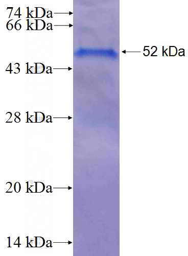 Recombinant Human RND1 SDS-PAGE