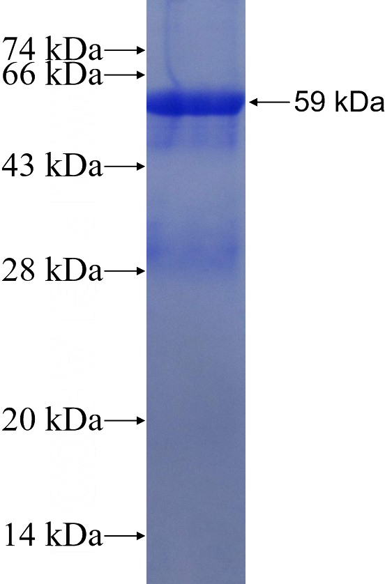 Recombinant Human FBXO22 SDS-PAGE