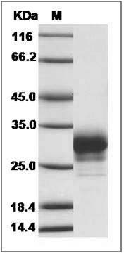 Human CD32a / FCGR2A Protein (167 His, His Tag) SDS-PAGE