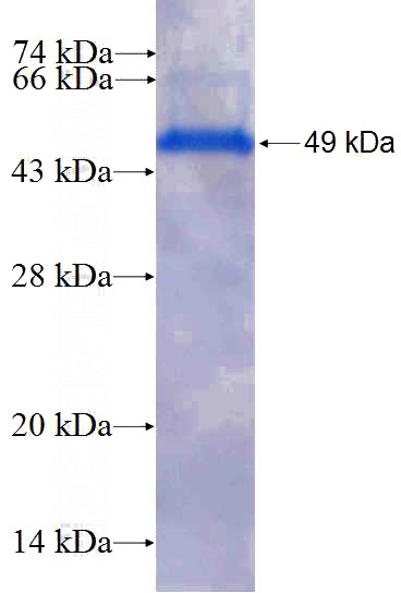 Recombinant Human APOBEC3C SDS-PAGE