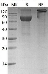 Human FCGR3B/CD16B/FCG3/FCGR3/IGFR3 (Fc & His tag) recombinant protein