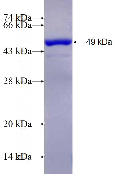 Recombinant Human EEA1 SDS-PAGE