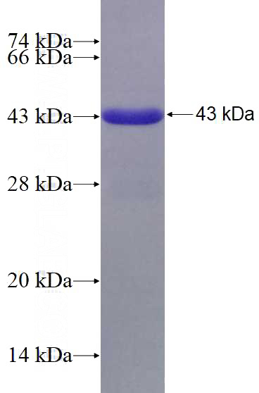 Recombinant Human PCDHB11 SDS-PAGE