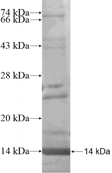 Recombinant Human EBLN2 SDS-PAGE