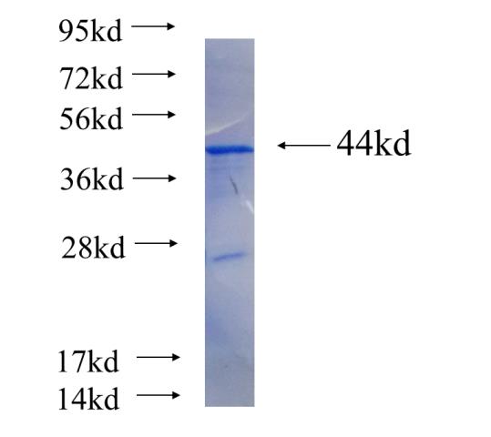 Recombinant human EDC3 SDS-PAGE