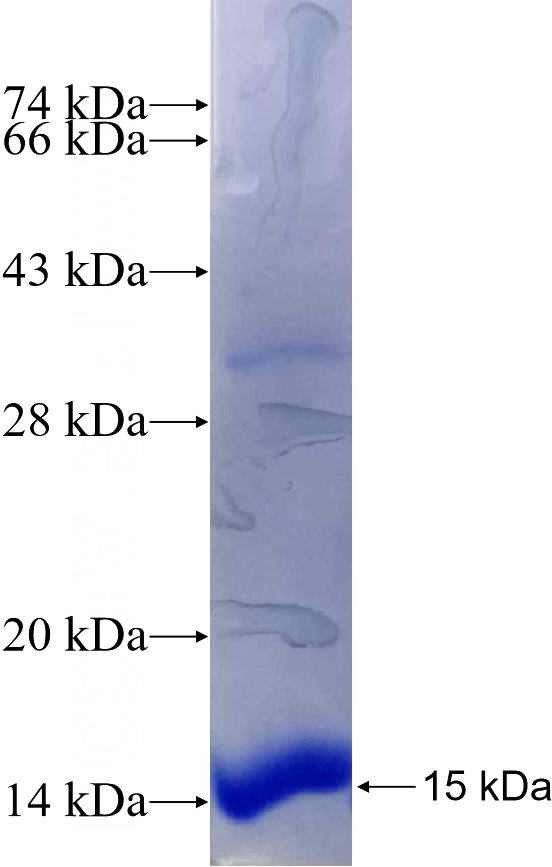 Recombinant Human CDA SDS-PAGE
